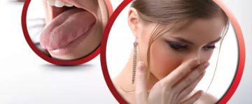 Mau Hálito (Halitose)